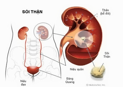 Nhận biết các dấu hiệu đau ở thận 2