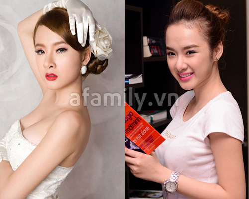 Những chiếc mũi 