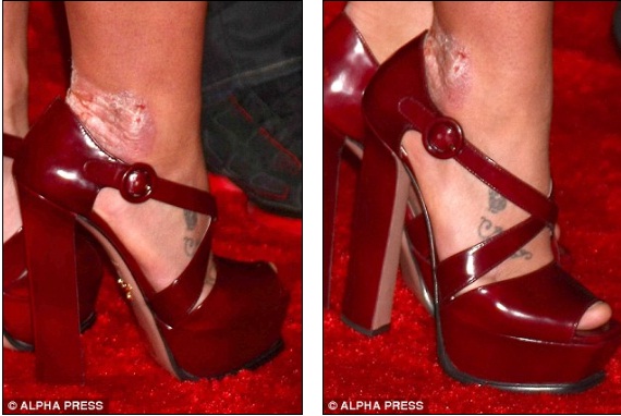 Britney Spears để lộ chân xấu xí 5
