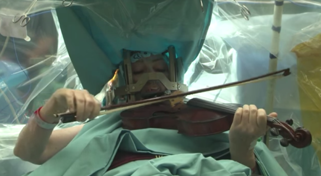 Chơi violin trong khi... phẫu thuật não 1