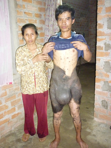 Chàng trai với “lớp da trâu” 1 Chàng trai với “lớp da trâu” 1