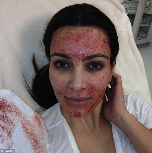 Kim Kardashian chăm sóc da mặt bằng... máu người  9