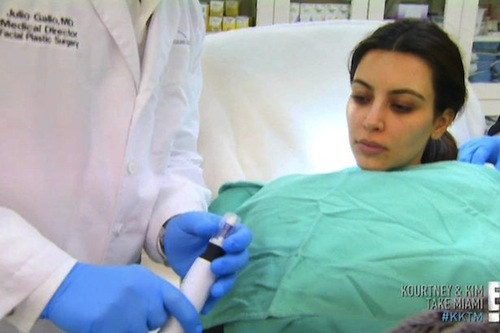 Kim Kardashian chăm sóc da mặt bằng... máu người  6