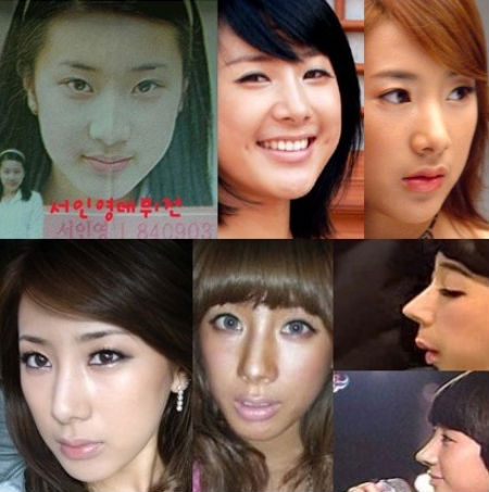 “Biểu tượng thời trang” xứ Hàn thừa nhận phẫu thuật mũi  2