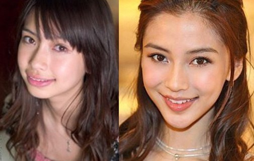 Angelababy phẫu thuật thẩm mỹ 