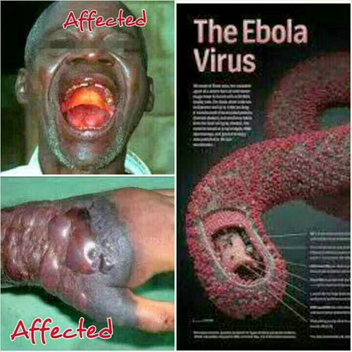 Ebola- Đại dịch đang đe dọa toàn thế giới 1