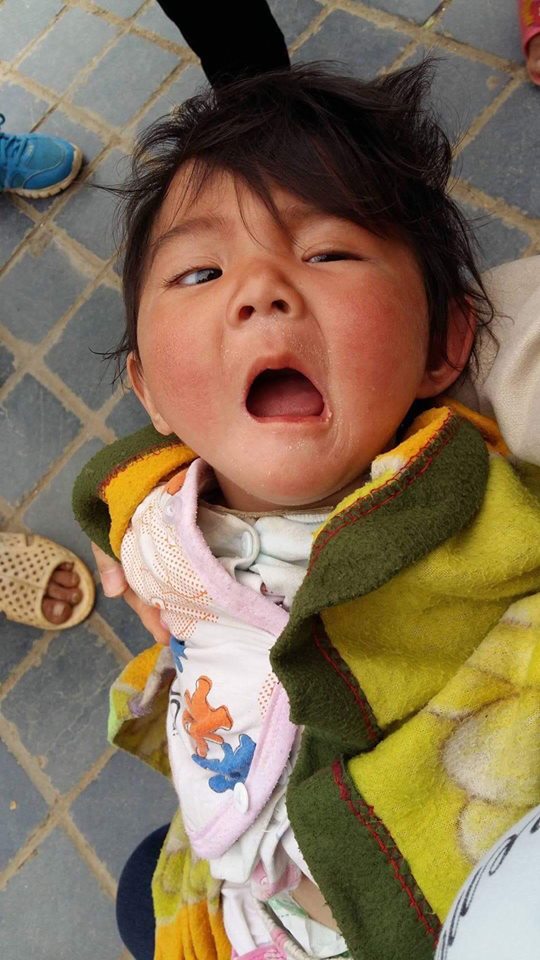 Sau hơn 3 tháng được mẹ nuôi chăm sóc, bé gái 14 tháng tuổi nặng 3,5kg giờ ra sao? Sau hơn 3 tháng được mẹ nuôi chăm sóc, bé gái 14 tháng tuổi nặng 3,5kg giờ ra sao?