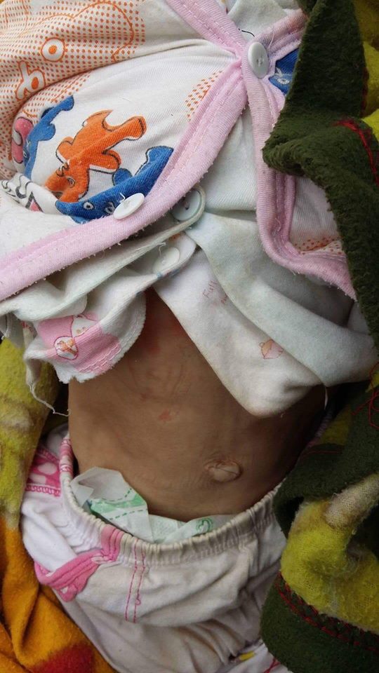 Sau hơn 3 tháng được mẹ nuôi chăm sóc, bé gái 14 tháng tuổi nặng 3,5kg giờ ra sao? Sau hơn 3 tháng được mẹ nuôi chăm sóc, bé gái 14 tháng tuổi nặng 3,5kg giờ ra sao?