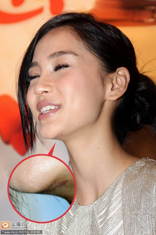 Vợ/bạn gái của mỹ nam Châu Á bị tố phẫu thuật thẩm mỹ Vợ/bạn gái của mỹ nam Châu Á bị tố phẫu thuật thẩm mỹ