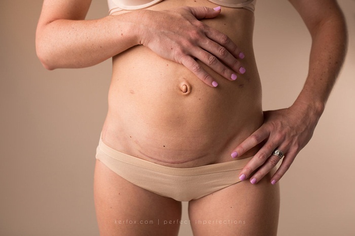 Cơ thể phụ nữ sau sinh 12