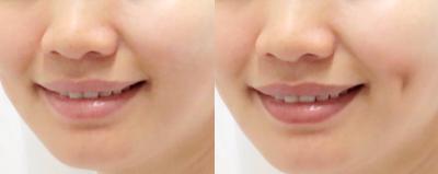Phương pháp PTTM lạ ở những điểm chẳng mấy ai ngờ tới 10 Phương pháp PTTM lạ ở những điểm chẳng mấy ai ngờ tới 10
