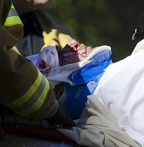 Tài tử Harrison Ford đau đớn với vết thương nặng từ vụ tai nạn máy bay 1