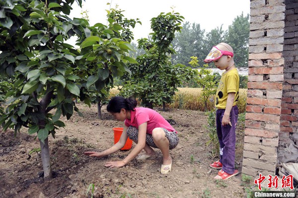 Cuộc sống đ&aacute;ng thương của c&ocirc; b&eacute; 6 tuổi bị bỏng to&agrave;n th&acirc;n 10