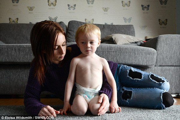 Kì lạ cậu bé 2 tuổi chỉ nặng bằng đứa trẻ 3 tháng 3