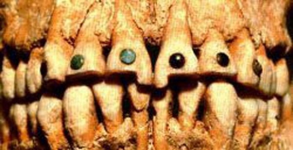Xem người Maya cổ đục và đeo đá quý vào... răng 3