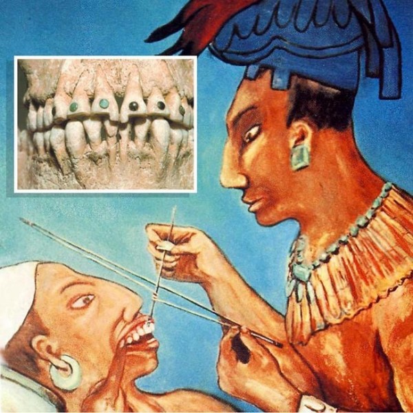 Xem người Maya cổ đục và đeo đá quý vào... răng 2