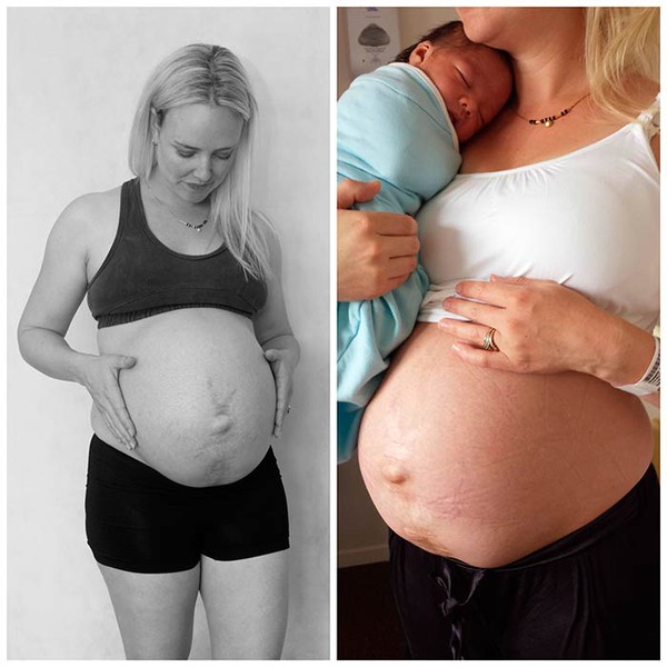 Những bức ảnh chân thực về sự thay đổi vóc dáng sau sinh của một bà mẹ