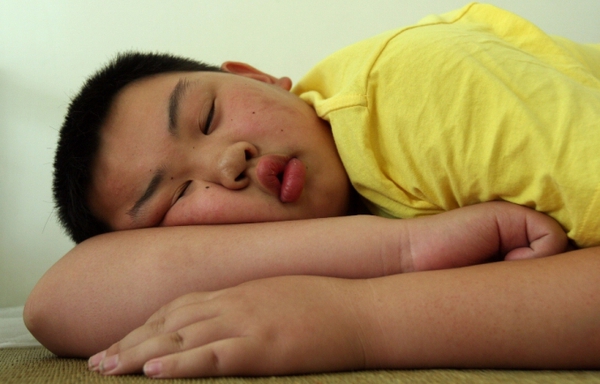 Trẻ em thiếu ngủ sẽ đẫn đến béo phì
