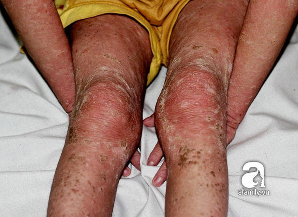 Cứu lấy b&eacute; mang bệnh 