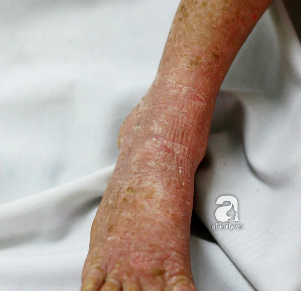 Cứu lấy b&eacute; mang bệnh 