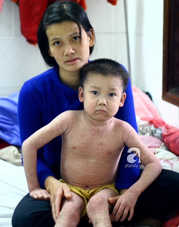 Cứu lấy b&eacute; mang bệnh 
