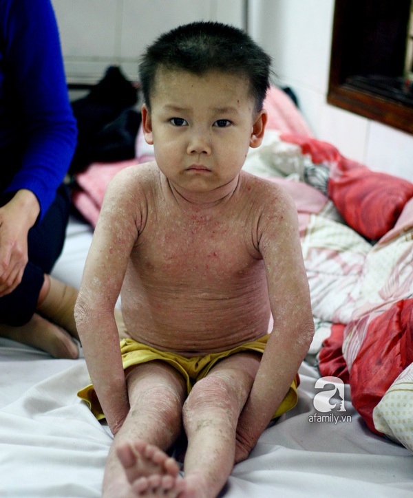 Cứu lấy b&eacute; mang bệnh 