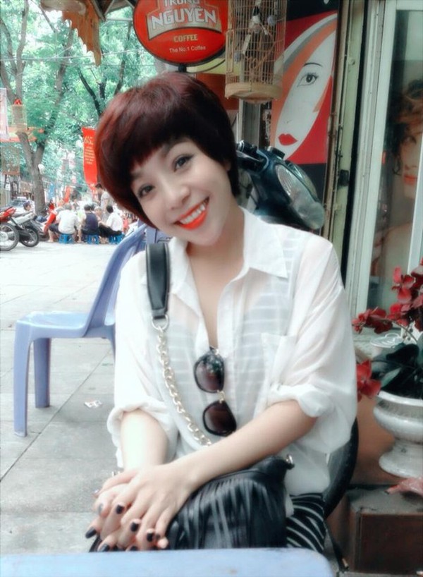 phẫu thuật cằm nhọn