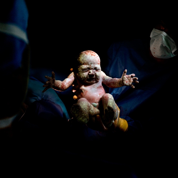 8 bức ảnh tuyệt đẹp chụp trẻ sơ sinh chỉ vài giây sau khi chào đời 3