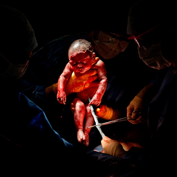 8 bức ảnh tuyệt đẹp chụp trẻ sơ sinh chỉ vài giây sau khi chào đời 5