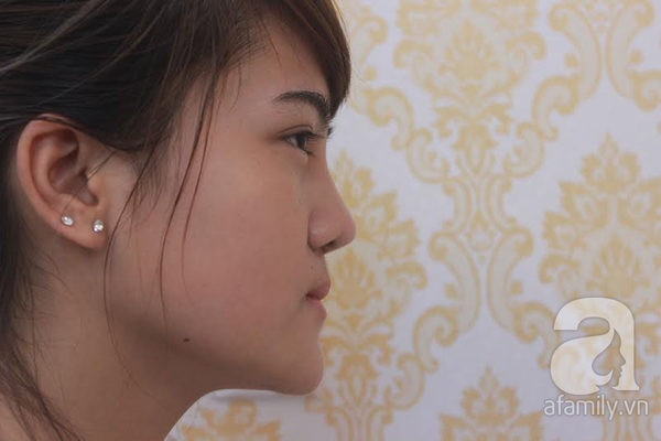 Độc quyền: Theo chân một thiếu nữ Hà Thành đi nâng mũi Sline 