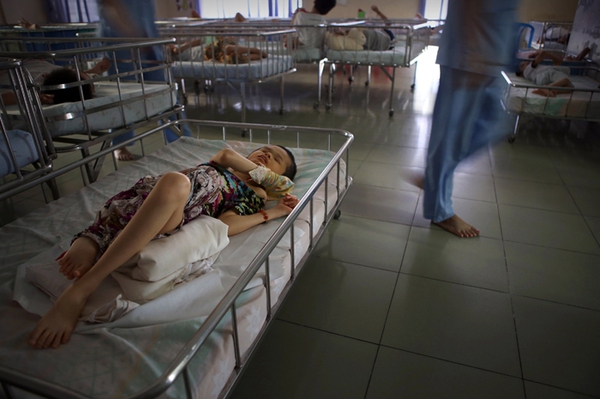 Nhói lòng trẻ Việt Nam nhiễm chất độc da cam trên báo nước ngoài 2