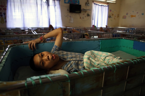 Nhói lòng trẻ Việt Nam nhiễm chất độc da cam trên báo nước ngoài 3
