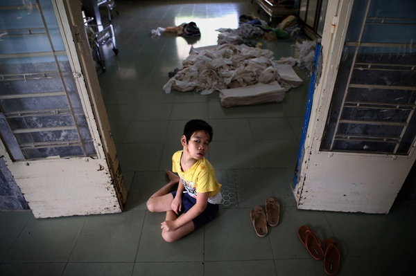 Nhói lòng trẻ Việt Nam nhiễm chất độc da cam trên báo nước ngoài 8