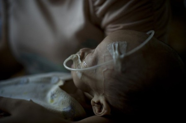 Bé gái 13 tháng tuổi nặng 2,9kg vì mắc bệnh lạ, bố mẹ đau đớn khẩn cầu sự giúp đỡ 5