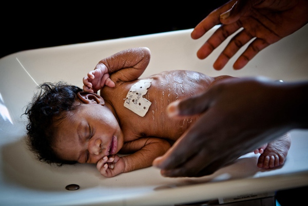 Cận cảnh sinh con trong các cơ sở y tế thiếu thốn ở châu Phi 8