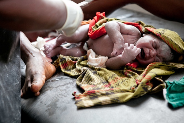 Cận cảnh sinh con trong các cơ sở y tế thiếu thốn ở châu Phi 6