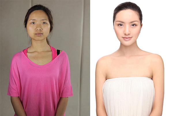 Loạt ảnh trước và sau phẫu thuật thẩm mỹ của 20 phụ nữ Trung Quốc gây sốc 1