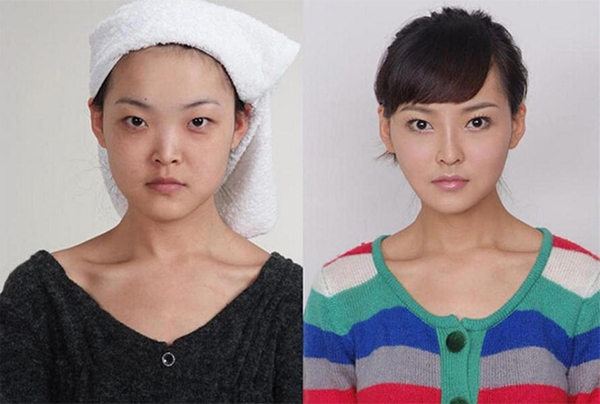 Loạt ảnh trước và sau phẫu thuật thẩm mỹ của 20 phụ nữ Trung Quốc gây sốc 15