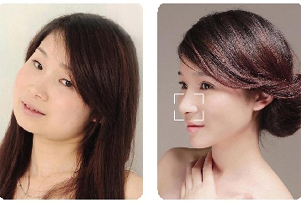 Loạt ảnh trước và sau phẫu thuật thẩm mỹ của 20 phụ nữ Trung Quốc gây sốc 16