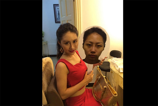 Loạt ảnh trước và sau phẫu thuật thẩm mỹ của 20 phụ nữ Trung Quốc gây sốc 17