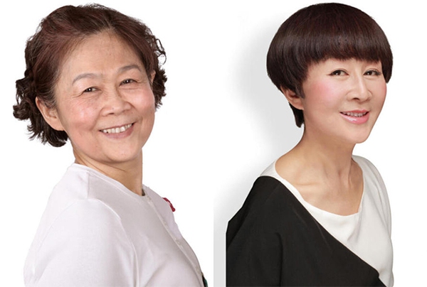 Loạt ảnh trước và sau phẫu thuật thẩm mỹ của 20 phụ nữ Trung Quốc gây sốc 18