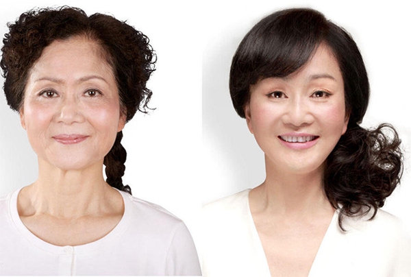 Loạt ảnh trước và sau phẫu thuật thẩm mỹ của 20 phụ nữ Trung Quốc gây sốc 19