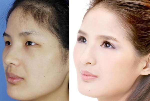 Loạt ảnh trước và sau phẫu thuật thẩm mỹ của 20 phụ nữ Trung Quốc gây sốc 13
