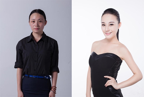 Loạt ảnh trước và sau phẫu thuật thẩm mỹ của 20 phụ nữ Trung Quốc gây sốc 4