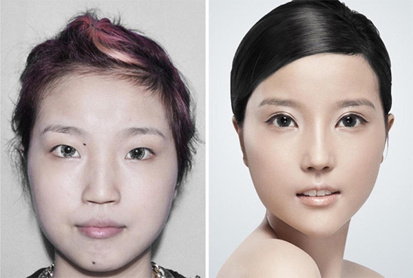 Loạt ảnh trước và sau phẫu thuật thẩm mỹ của 20 phụ nữ Trung Quốc gây sốc 6