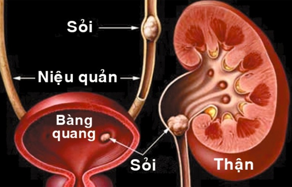 tan soi qua da