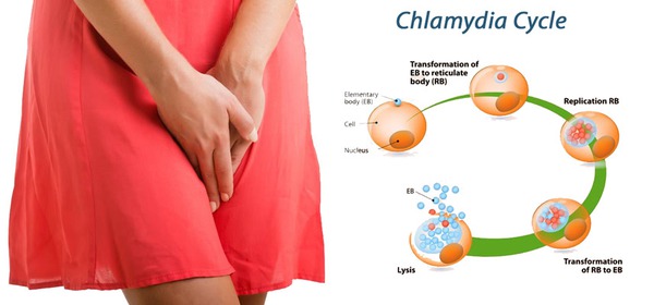 bệnh tình dục bệnh tình dục