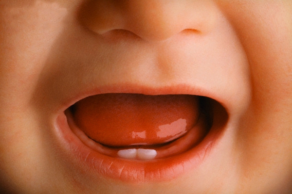 6 điều cần đặc biệt chú ý khi con thay răng 1