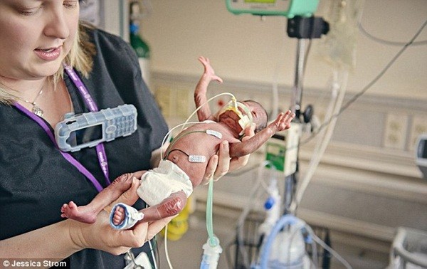 Những h&igrave;nh ảnh v&ocirc; c&ugrave;ng cảm động trong ph&ograve;ng chăm s&oacute;c t&iacute;ch cực cho b&eacute; sơ sinh 5