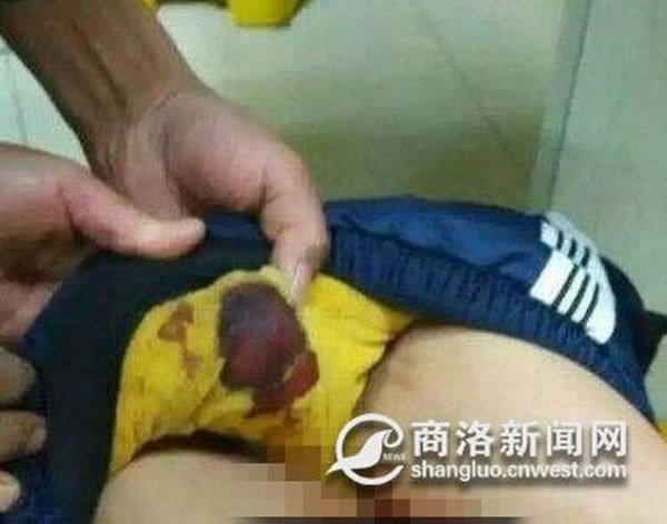 bao quy đầu bao quy đầu